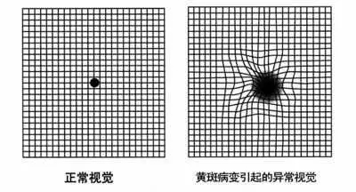 拯救五类“恶”视力，它们可能令你致盲！