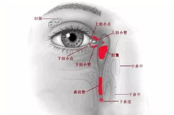 泪道阻塞的方法