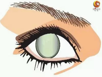 眼科医生：老花眼减轻先别高兴！可能是这个病的前兆