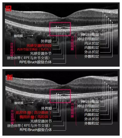 眼底OCT分层，一文教你全看懂！