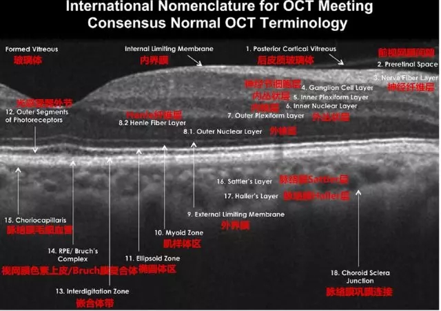 眼底OCT分层，一文教你全看懂！